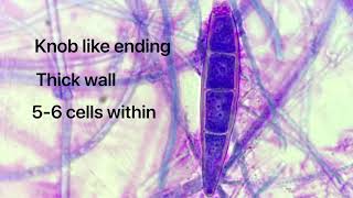 Microsporum canis cytology [upl. by Heloise]