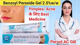 Acne की लाजवाब दवा  Benzoyl peroxide gel 25  Benzoyl peroxide for acne [upl. by Haneehs]