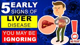 5 Liver Disease Symptoms You Can’t Afford to Ignore liverdisease [upl. by Kcirddet]