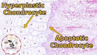 Epiphyseal Growth Plate Histology  Time to Zone Out [upl. by Eema453]