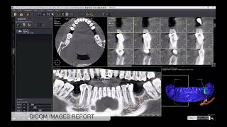 Rapport dimages Dicom [upl. by Yoshi432]