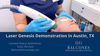 Laser Genesis Treatment Demo  Balcones Dermatology amp Aesthetics Austin TX  Ph5124594869 [upl. by Lladnyk62]