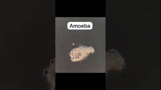 amoeba nutrition in amoeba ingestion of food through pseudopodia amazing animals protozoa [upl. by Asselim]