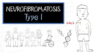 What is Neurofibromatosis Type 1 NF1 [upl. by Dacy]