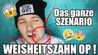 WEISHEITSZAHN OP  Das ganze SZENARIO TAGEBUCH  😰😪 [upl. by Axe159]