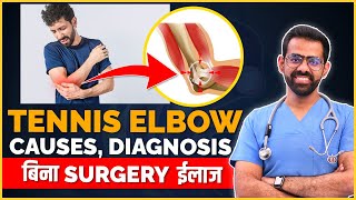 Tennis Elbow Lateral EpicondylitisCauses  Diagnosis  Non Surgical Treatment [upl. by Janos]