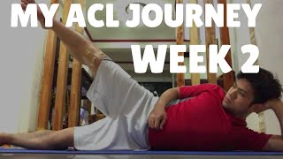 My ACL Surgery Journey Week 2 [upl. by Eniloj]