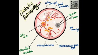 Retinal Abnormalities findings in Ophthalmoscope Examination  Made Easy   مشاكل الشبكية [upl. by Llewellyn173]