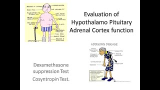 Dexamethasone suppression test [upl. by Smith]