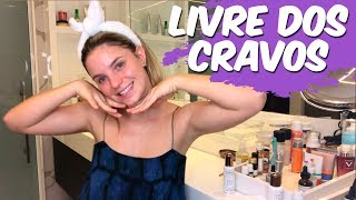 COMO ACABAR COM OS CRAVOS  SKINCARE PARA CRAVOS [upl. by Wivina]