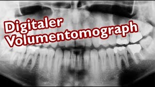 Was ist ein DVT Digitaler Volumentomograph [upl. by Hannan335]