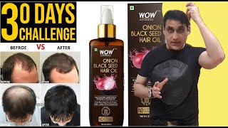 WOW Onion Hair Oil With Black Seed Oil  No More Hair Fall  How To Use Onion Oil For Hair Growth [upl. by Noslien628]