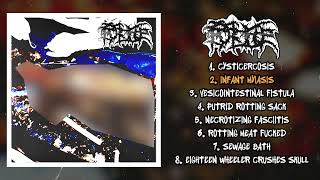 Putricine  st FULL EP 2023  Goregrind [upl. by Onfre]