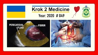 Krok 2 Medicine  Year 2020  049 Ministry of Public Health of Ukraine [upl. by Kerge630]