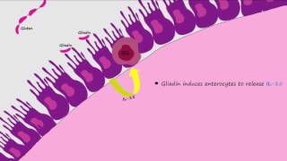 Celiac Disease Pathogenesis Described Concisely and in Detail [upl. by Avril621]