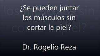 Abdominoplastía ¿Se pueden juntar los músculos sin cortar piel [upl. by Christabella]