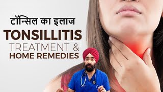 Tonsil ka Poora Ilaaj  Home Treatment and medicines for Tonsillitis  DrEducation [upl. by Skrap]