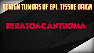 KERATOACANTHOMA  BENIGN EPI TUMOR [upl. by Epilef891]