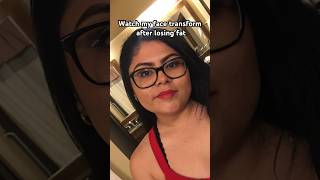 Face fat loss transformation   weight loss  fatloss weightloss weightlosstransformation [upl. by Goldston788]