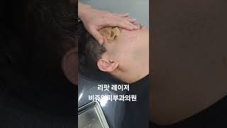 리팟 레이저 다발성 흑자 세종리팟 세종시리팟 reepot lentigo multiplelentigo 청주리팟 공주리팟 대전리팟 오창리팟 오송리팟 부여리팟 [upl. by Adnovoj]