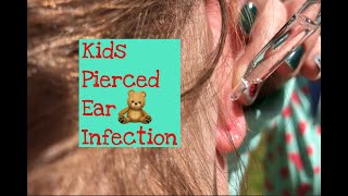 🐻🎈Naturally Healing  Kids Pierced Ear Infection [upl. by Sukram330]