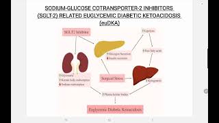 SGLT 2 Inhibitor Associated euglycemic Diabetic Ketoacidosis [upl. by Sivrat]