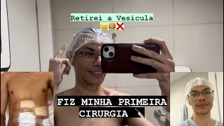 MEDVLOG FIZ CIRURGIA PARA TIRAR A VESÍCULA COLECISTECTOMIA medvlog cirurgia vesicula [upl. by Berkshire110]