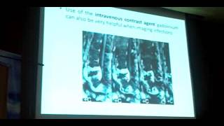 Pyogenic Spine Infections Dr Fady Michael [upl. by Hayyikaz]