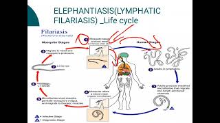 ElephantiasisLYMPHATIC FILARIASIS [upl. by Ramalahs]