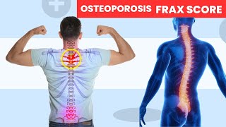 How to Detect Osteoporosis osteoporosis [upl. by Ahsakal]