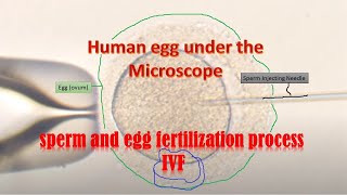 Human eggs under the Microscope during IVF fertilization [upl. by Len]