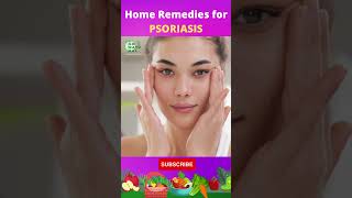 3 Home Remedies for Psoriasis [upl. by Eterg]