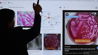 Klebsiella Pneumoniae USMLE Step 1 2021 Microbiology lecture 27 page145 [upl. by Casia]