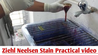 Ziehl Neelsen Stain ZN Stain  Acid Fast Staining  ZN Stain Microbiology Practical Class [upl. by Norrek837]