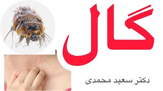 scabies چرا گال میگیریم ؟ درمانش چیه ؟ [upl. by Acinok900]