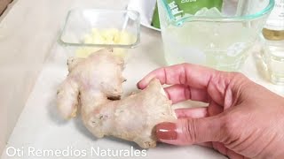 Crece tu Cabello con JengibreSabila y Aceites Naturales [upl. by Petuu193]