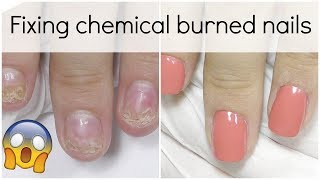 Extremely damaged nail transformation  How to fix it with Polygel [upl. by Ynnor490]