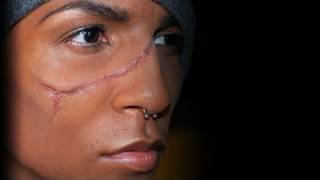 quotScarring Liquidquot Rigid Collodion [upl. by Evets]