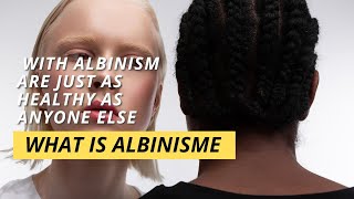 What Is Albinism [upl. by Otilegna]