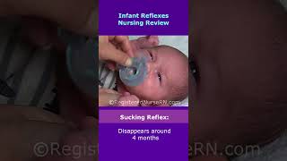 Infant Reflexes Nursing Review in 48 Seconds shorts nursing nclex [upl. by Aynotel]