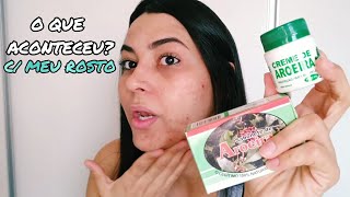 SABONETE E CREME DE AROEIRA  PELE COM ACNE  CRIS MARIA [upl. by Ruelu]