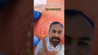 Skin infection explained  Dr khaled sadek skincare [upl. by Vashtee823]