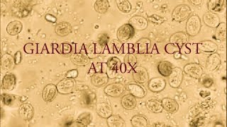 Giardia lamblia cyst under microscope at 40X [upl. by Merlin]