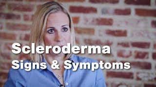 Signs and Symptoms of Scleroderma  Johns Hopkins [upl. by Ehcnalb]