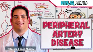 Peripheral Artery Disease [upl. by Tandie]