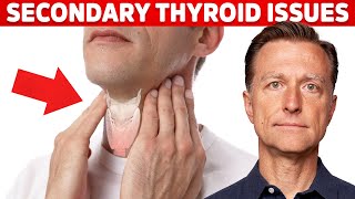 Most Thyroid Issues Are Secondary to Other Problems – Dr Berg [upl. by Raynold]