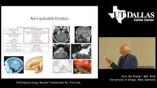 PathophysiologyBased Treatments for Tinnitus [upl. by Enohpesrep]