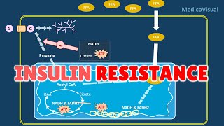 Insulin Resistance Part 2 Basal Lipolysis Free Fatty Acids and Randle cycle Hypothesis [upl. by Fanestil]