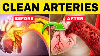 ✅Top 15 Foods to Unclog Arteries and Boost Heart Health [upl. by Anelegna]