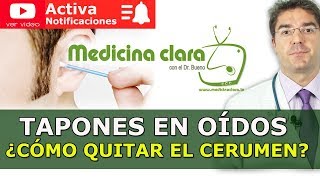 Tapones de cera en oídos ¿Cómo quitar el cerumen de los oídos Medicina Clara [upl. by Aramak344]